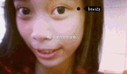 整容网红吃瓜,揭秘网红们的“美丽陷阱”