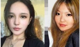 整容网红吃瓜,揭秘网红们的“美丽陷阱”