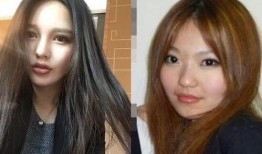 整容网红吃瓜,揭秘网红们的“美丽陷阱”