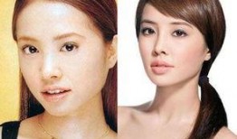 爆料明星整容视频,视频曝光惊人内幕